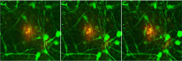 3차원으로 분화된 알츠하이머 신경세포 밖에 응집된 베타아밀로이드(붉은색)의 연속 절단면 영상. - 한국기초과학지원연구원 제공